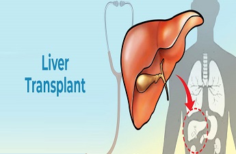 Consult with India’s leading surgical gastroenterologist for liver transplant 