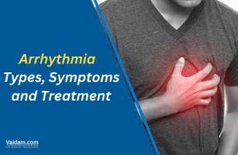 Arrhythmia: Types, Symptoms and Treatments