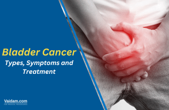 Understanding Bladder Cancer Treatment Options