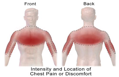 location of chest pain