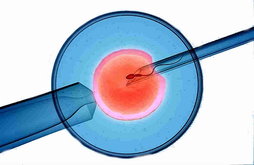 Intra-vitro fertilization
