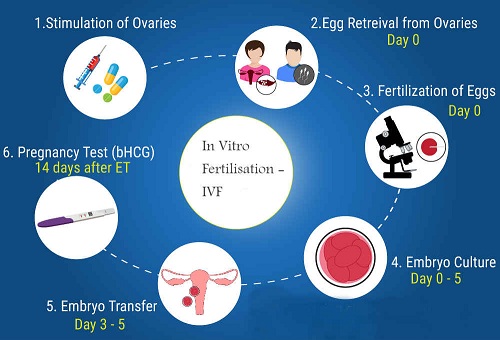 steps in IVF