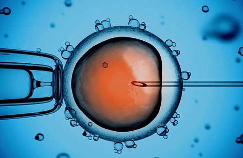 IVF treatment in India