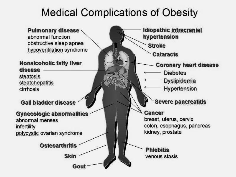 Problems caused by obesity