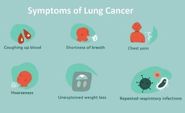 Symptoms of lung cancer 