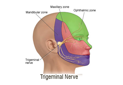 area affected in trigeminal neuralgia