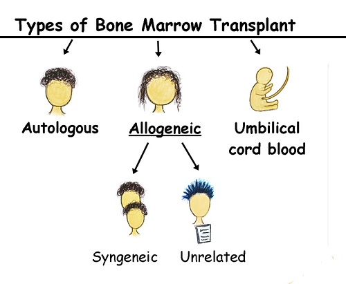 Types of Bone Marrow Transplant