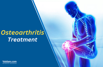 Osteoarthritis: Risk Factors, Symptoms, and Treatment