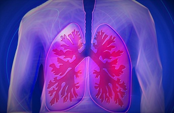 Is Pulmonary Fibrosis Fatal? Here are some true facts.