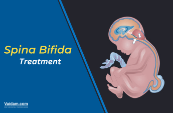 Understanding Spina Bifida: Causes, Prevention, and Treatment