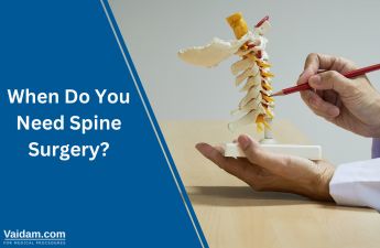 When Do You Need Spine Surgery?