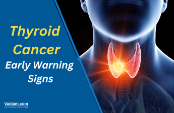 Early warning signs of thyroid cancer