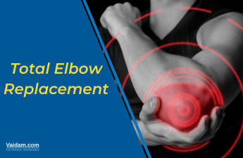 Total Elbow Replacement: Procedure and Outcomes